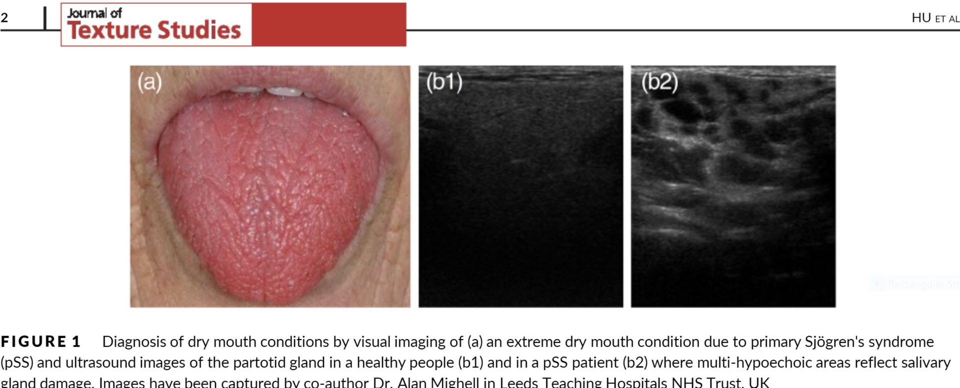 New review article on dry mouth published in Journal of Texture Studies